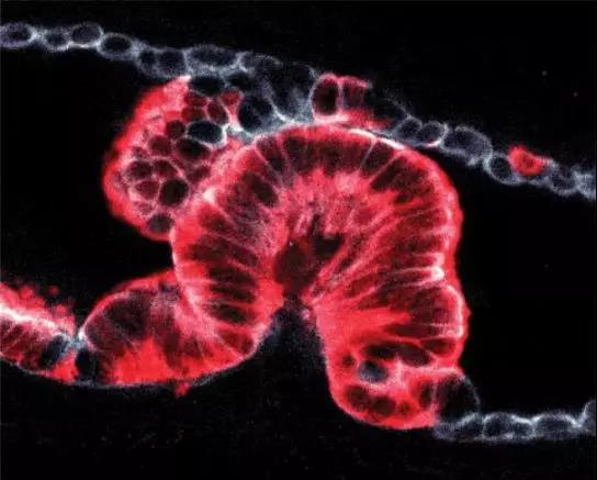 Nature:组织活检与3D技术两开花，揭秘癌症之王起