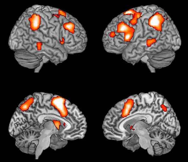 视觉识别物体时的fMRI图像